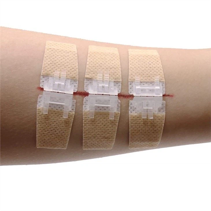 Wound Closure For Wound Care First Aid
